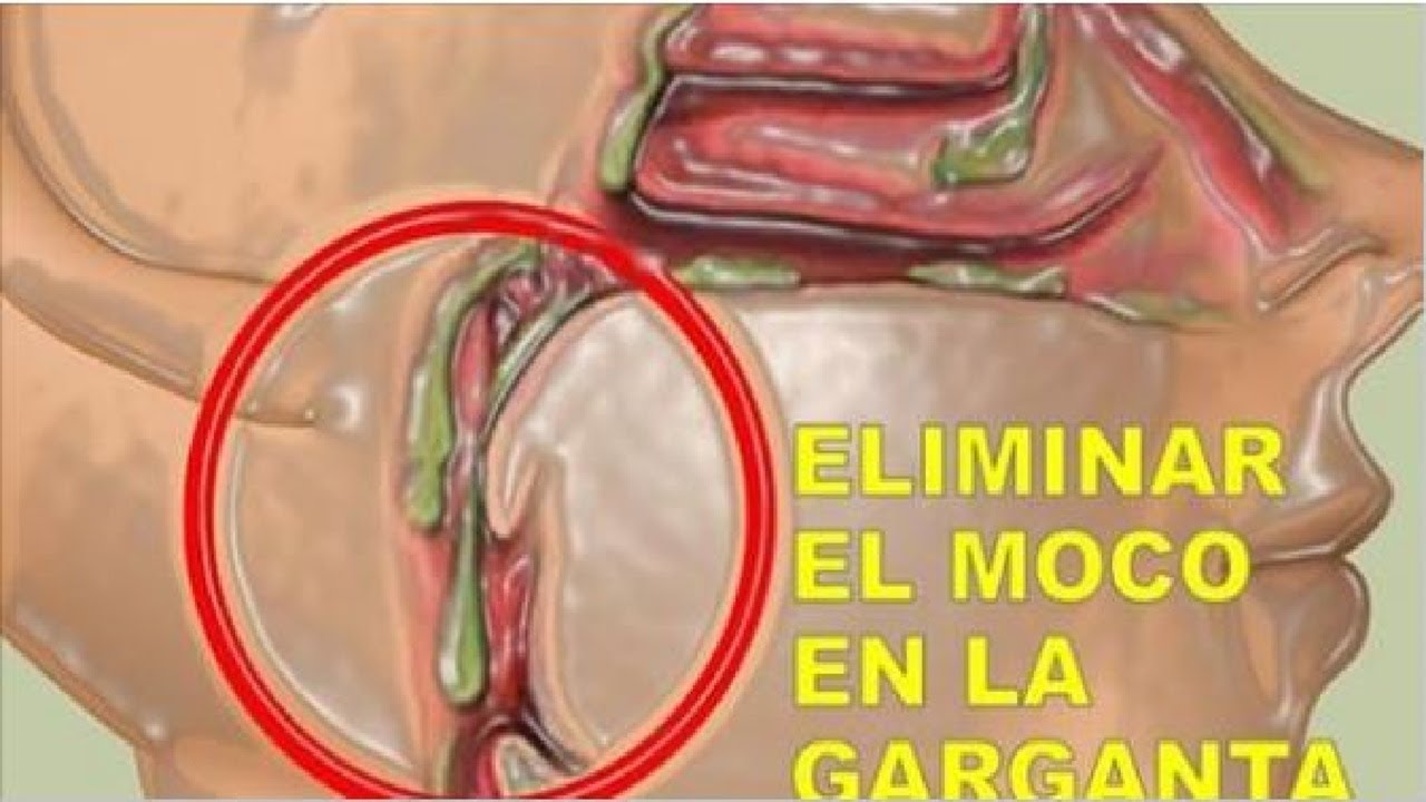 Como sacar la flema de la garganta