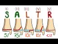 Salter-Harris Classification Made Easy To Remember