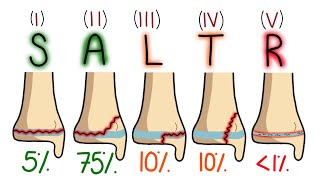 Salter-Harris Classification Made Easy To Remember