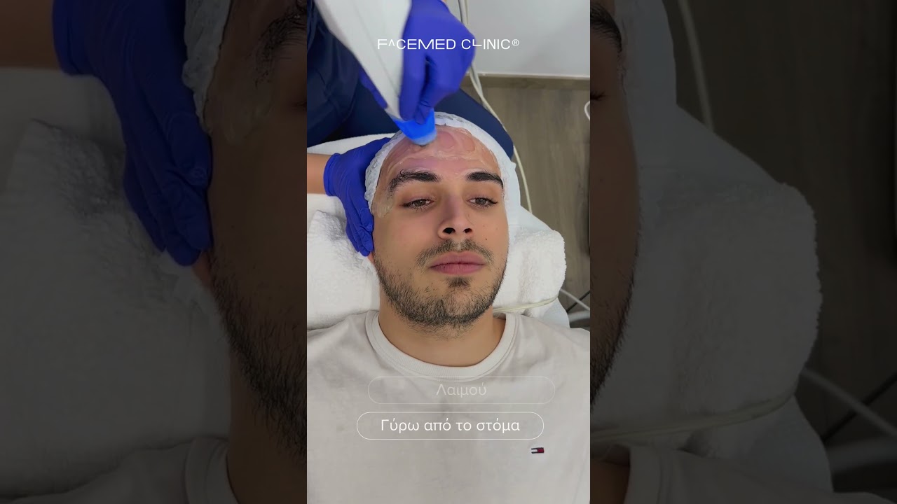 Exilis Elite Προσώπου