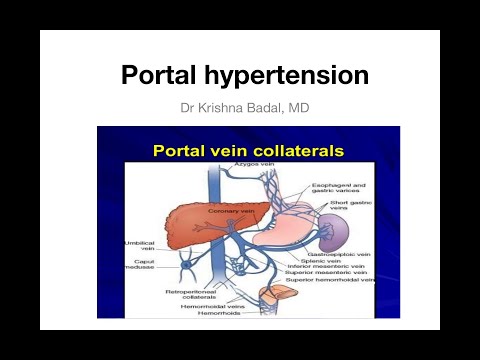 Portal hypertension in children