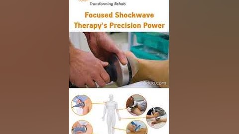 Focus Shockwave Therapy PiezoWave .Extracorporeal shockwave therapy (ESWT) with the PiezoWave