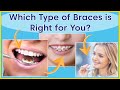 Types of orthodontic treatment  which braces are right for you