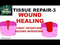 TISSUR REPAIR Part 3: WOUND HEALING, Factors affecting wound healing.