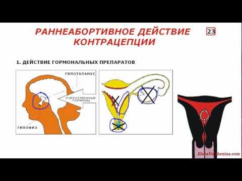 Восстановление плодности после удаления спирали, Урок4