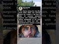 A U.S Marine during the Iraq war james Blake Miller was Severely injured