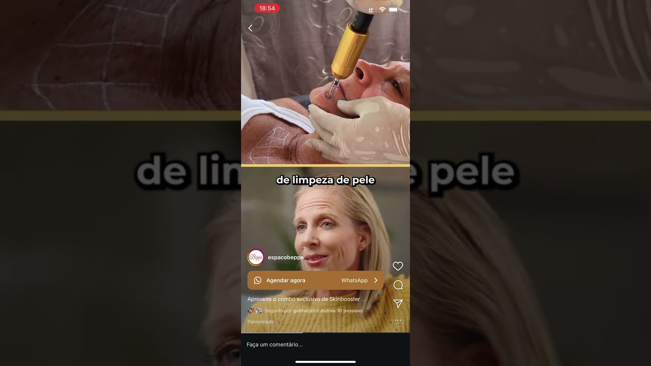 Client Work – Split-Screen AI Avatar Reels Ad for Aesthetic Clinic