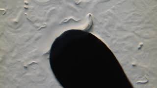 picking worms up close