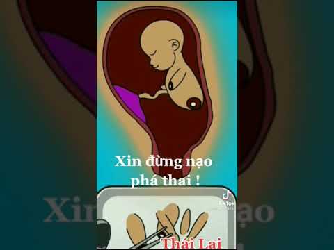 Video: 23 trang phục thú cưng không hài hước sẽ khiến bạn cười khúc khích suốt cả ngày dài