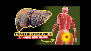 😱 Не игнорируй эти симптомы! Так печень кричит о помощи!
