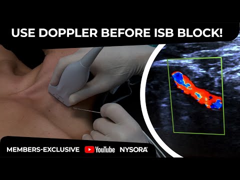 Image of ALWAYS USE DOPPLER BEFORE THE BRACHIAL PLEXUS BLOCK - Crash course with Dr. Hadzic