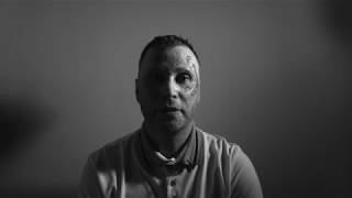 Pass The Light Trailer Series 1 - Shedding Light on Mental Health & Disfigurements -  TDF