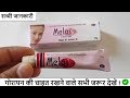 Melas cream Review in Hindi | गोरापन क्रीम ! How to use, Side Effects, Melasma