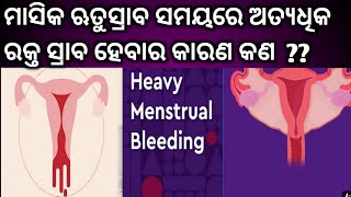 Heavy Bleeding in Periods in Odia।Heavy Menstrual Bleeding। Health Tips।Period Problem ।Women Health