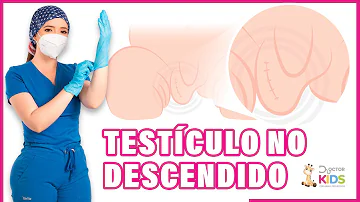 ¿Cómo puedo saber si el testículo de mi hijo no se ha caído?