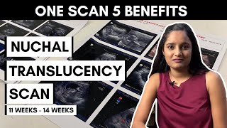 5 Benefits of Nuchal Translucency Scan (NT scan) | Pregnancy Scan (1114 weeks)