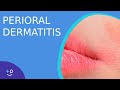 Perioral Dermatitis - Daily Do's of Dermatology