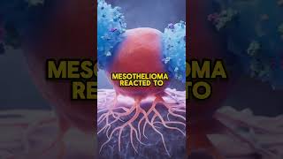 Could This Drug Combination Help Mesothelioma Patients?