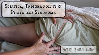 Sciatica, Trigger Points & Piriformis Syndrome: Soft Tissue Manipulation