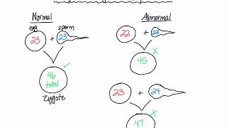 Chromosomal Abnormalities