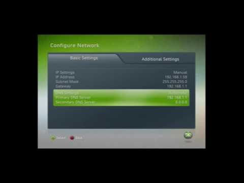 How to Forward Ports Xbox 360 Static IP HD!!!!! BEST! Speed up connection! OPEN NAT!!!!