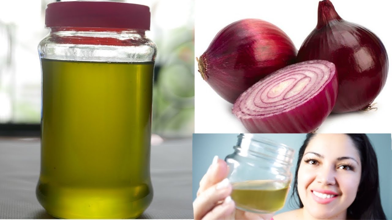ACEITE DE CEBOLLA PARA HACER CRECER EL CABELLO Y REDUCE LA CAIDA - AANGIE -  YouTube