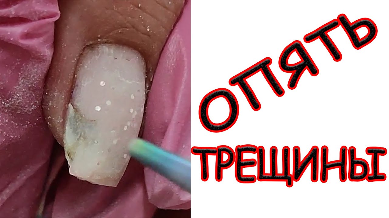 ОПЯТЬ ТРЕЩИНЫ // РЕМОНТ СТЕКЛОВОЛОКНОМ - YouTube