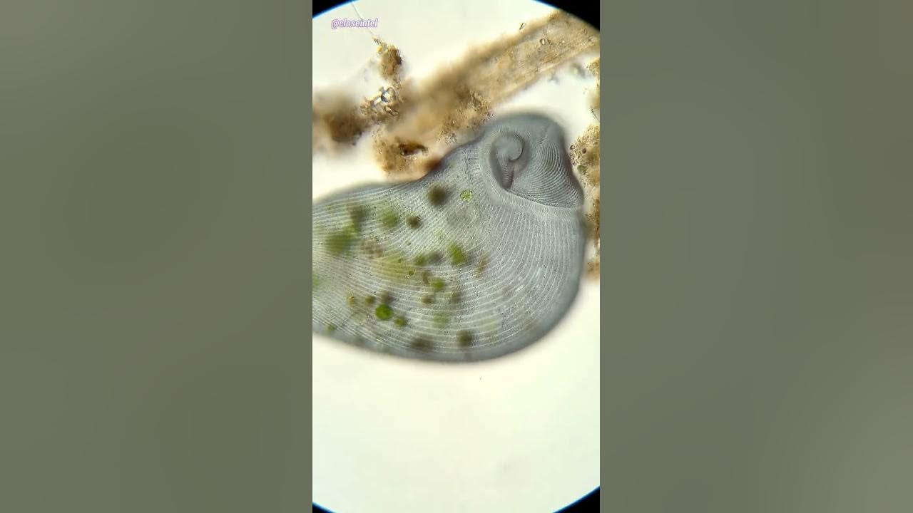 one-of-the-largest-single-cell-organisms-on-earth-stentor-coeruleus