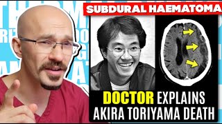 Doctor Explains Akira Toriyamas Death Subdural Haematoma Explained