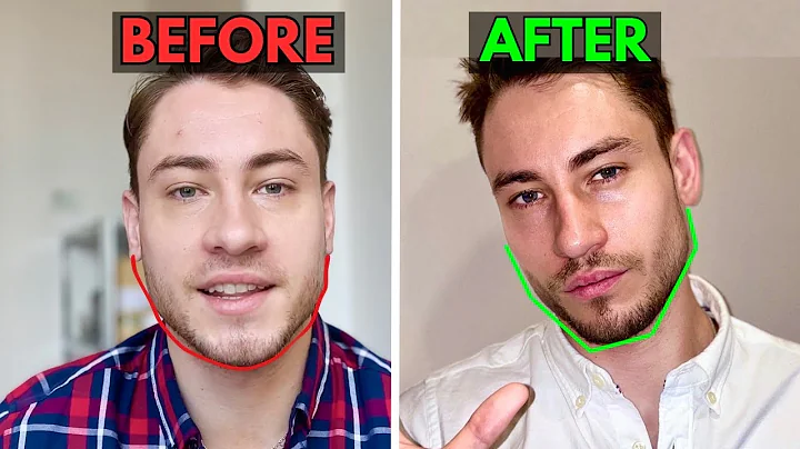 The 5 BEST Mewing Exercises (ADVANCED Daily Routine)