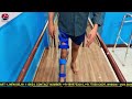 Stance control polio knee caliper becker orthopedic usa  bornlife artificial limbs center