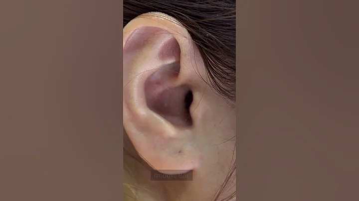Tinnitus EXPOSED - Surprising Causes of Ringing in Ears #3 - DayDayNews
