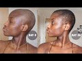 1-month update post shaving my hair: MY SCALP CARE ROUTINE | Hair Growth