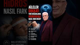 Aileler dikkat: Yeni doğanlarda hidrosefali nasıl fark edilir? #bebek #hidrosefali #beyin #shorts