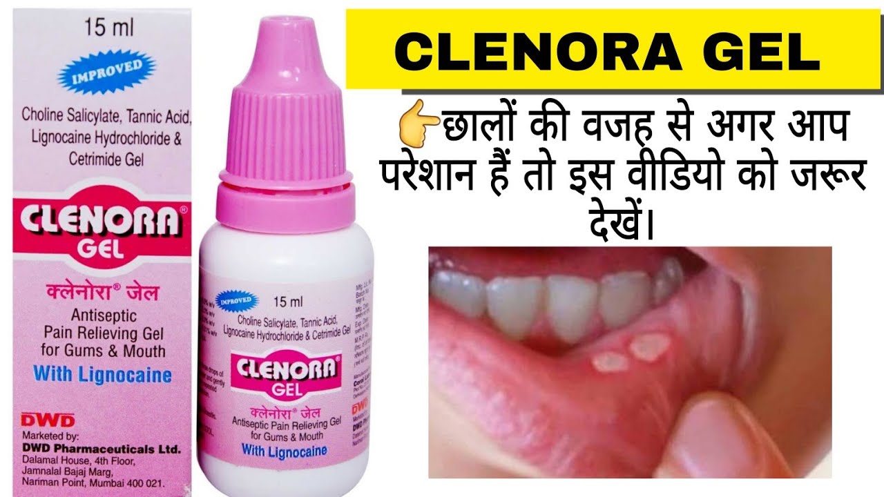 Clenora Gel for mouth ulcer / Apthous Ulcer / Stomatitis / Glossitis