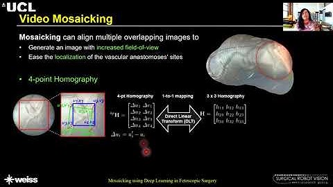 IJCARS MICCAI 2019 Best Paper: Deep learning-based Fetoscopic Mosaicking for Field-of-View Expansion