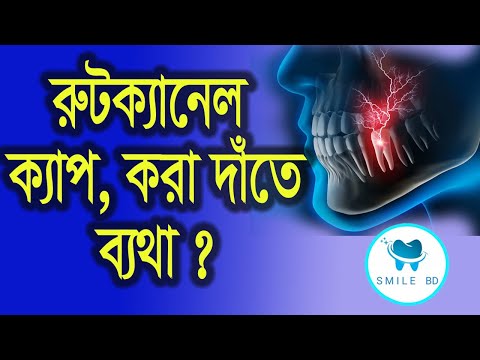 রুটক্যানেল বা ক্যাপ করা দাঁতে ব্যথা কেন হয় ,হলে কি করবেন??dental tips in bangla by smile bd..