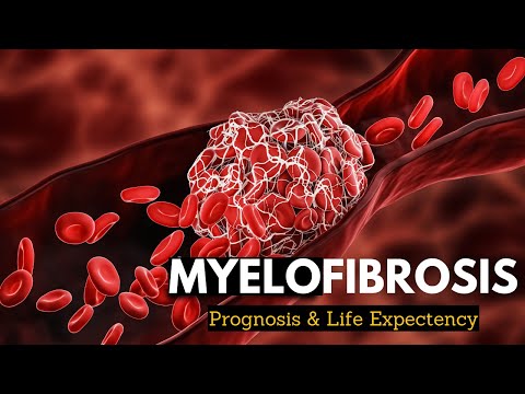 Video: Myelofibrose