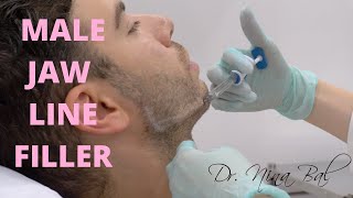 🆕 Male Jawline Fillers Before And After 💕 Dr Nina Bal💕 Jawline Transformation