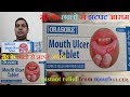 how to remove mouth ulcer easy &amp; fast ? by Easy Nuskhe