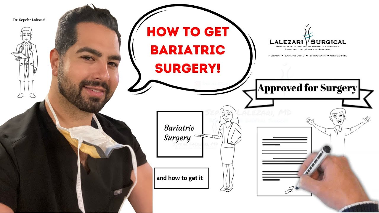 Bariatric surgery: Step by step guide on how to get Weight Loss Surgery ...