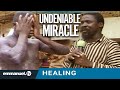 UNDENIABLE MIRACLE!!!   TB Joshua Early Ministry Footage