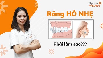 RĂNG HÔ NHẸ PHẢI LÀM SAO - CÓ CẦN NIỀNG KHÔNG | NHA KHOA VÂN ANH
