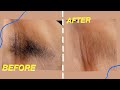 WAXING UNDERARMS Using DIY Sugar Wax | abetweene