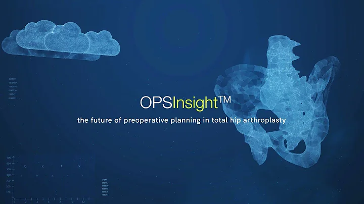 OPSInsight: preoperative planning for total hip ar...