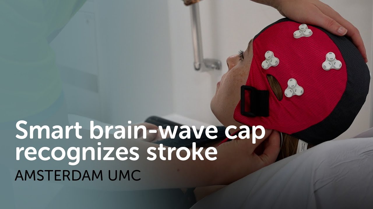 Smart brain-wave cap recognizes stroke before the patient reaches