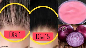 ¿Cómo puedo hacer crecer mi cabello sin que se caiga?