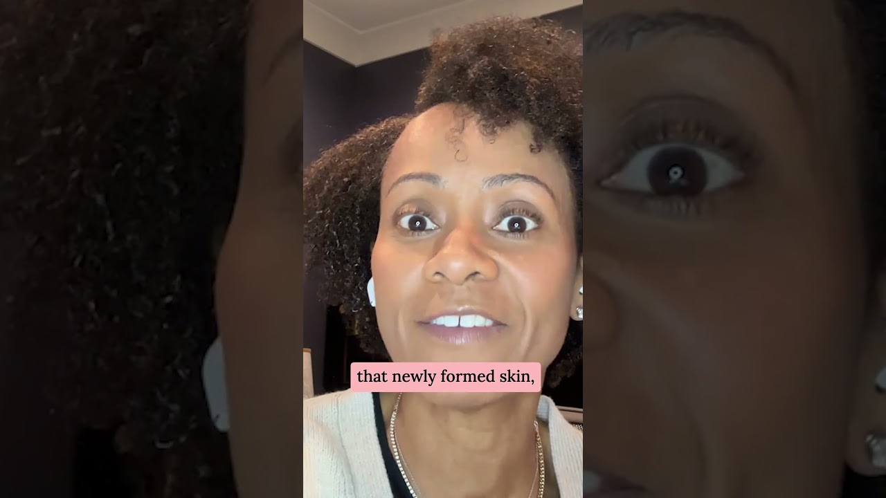 Why Dermatologists Say No To Peels & Laser Treatments