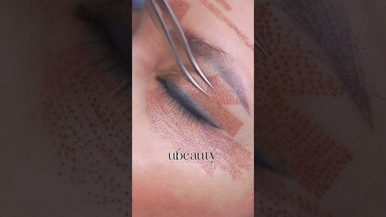 Special patern for eyelids lifting#phiion #plasmapen #plasmafibroblast #phiacademy #beauty #ubrow