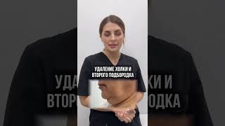 Результат БЕЗ операции - как работает Эндолифт? 😱